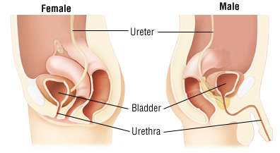 Urethritis-Herbal-Treatment